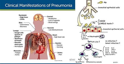 Clinical Overview of Mycoplasma pneumoniae Infection